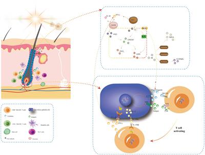 Oxidative stress and alopecia areata